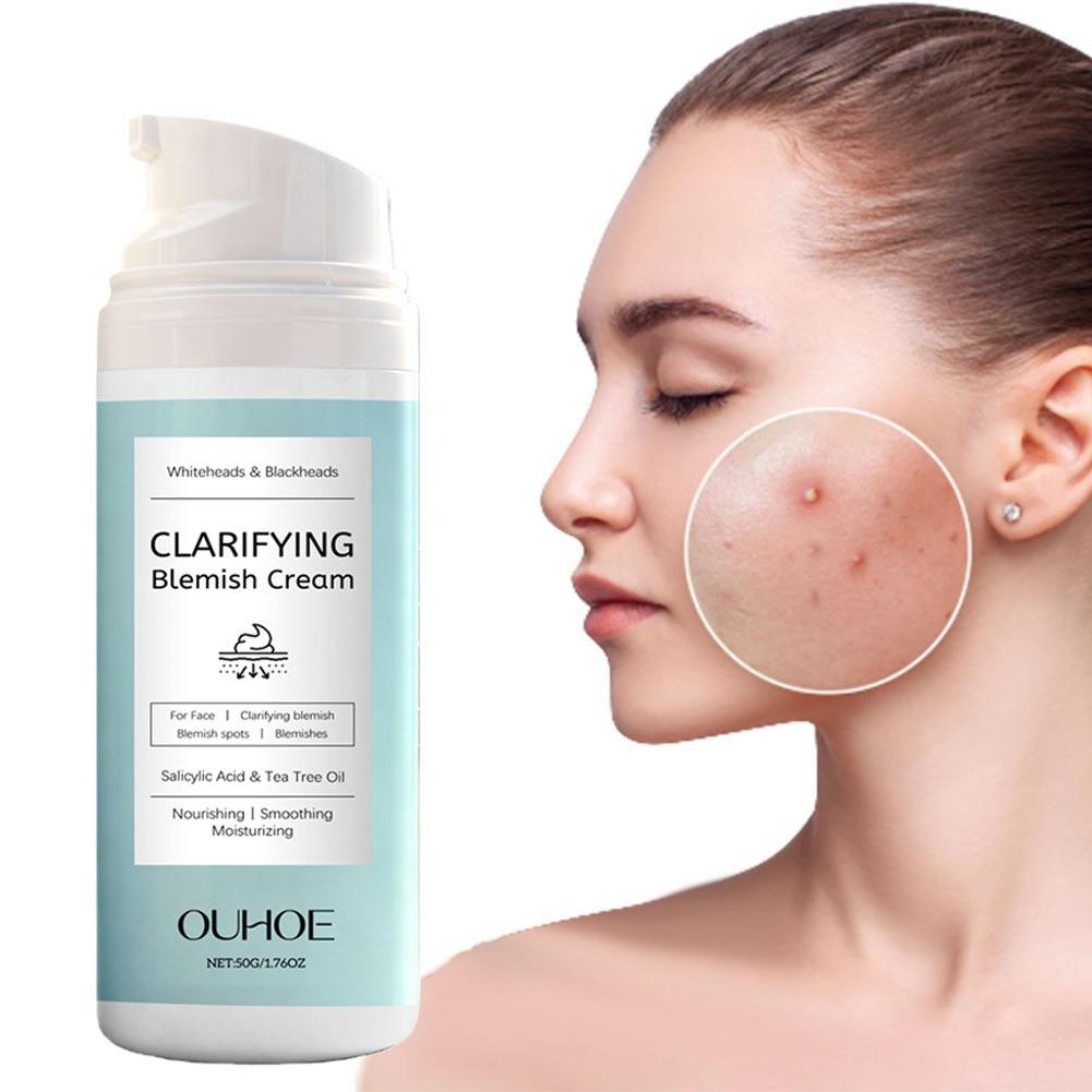 Azelaic Acid Cream - Salicylsäure-Gesichtscreme für zu Akne neigende Haut,