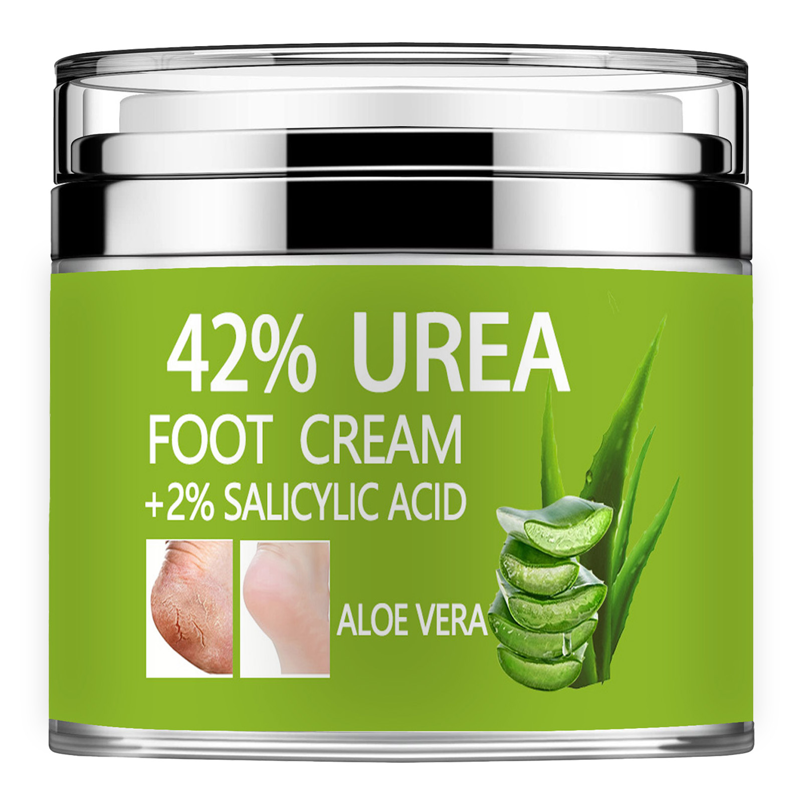 Azelaic Acid Cream - Harnstoffcreme 42 % Plus Salicylsäure 2