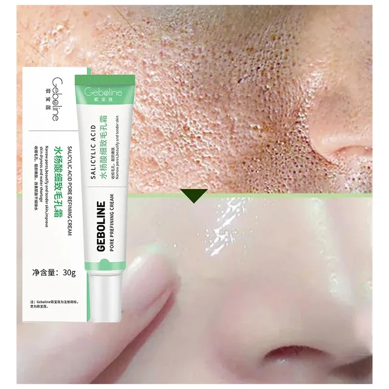 Salicylsäure Poren schrumpfend – Azelaic Acid Cream Bewertung und Preis