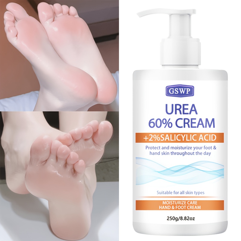 GSWP 60% Urea Feuchtigkeitscre – Azelaic Acid Cream Bewertung und Preis