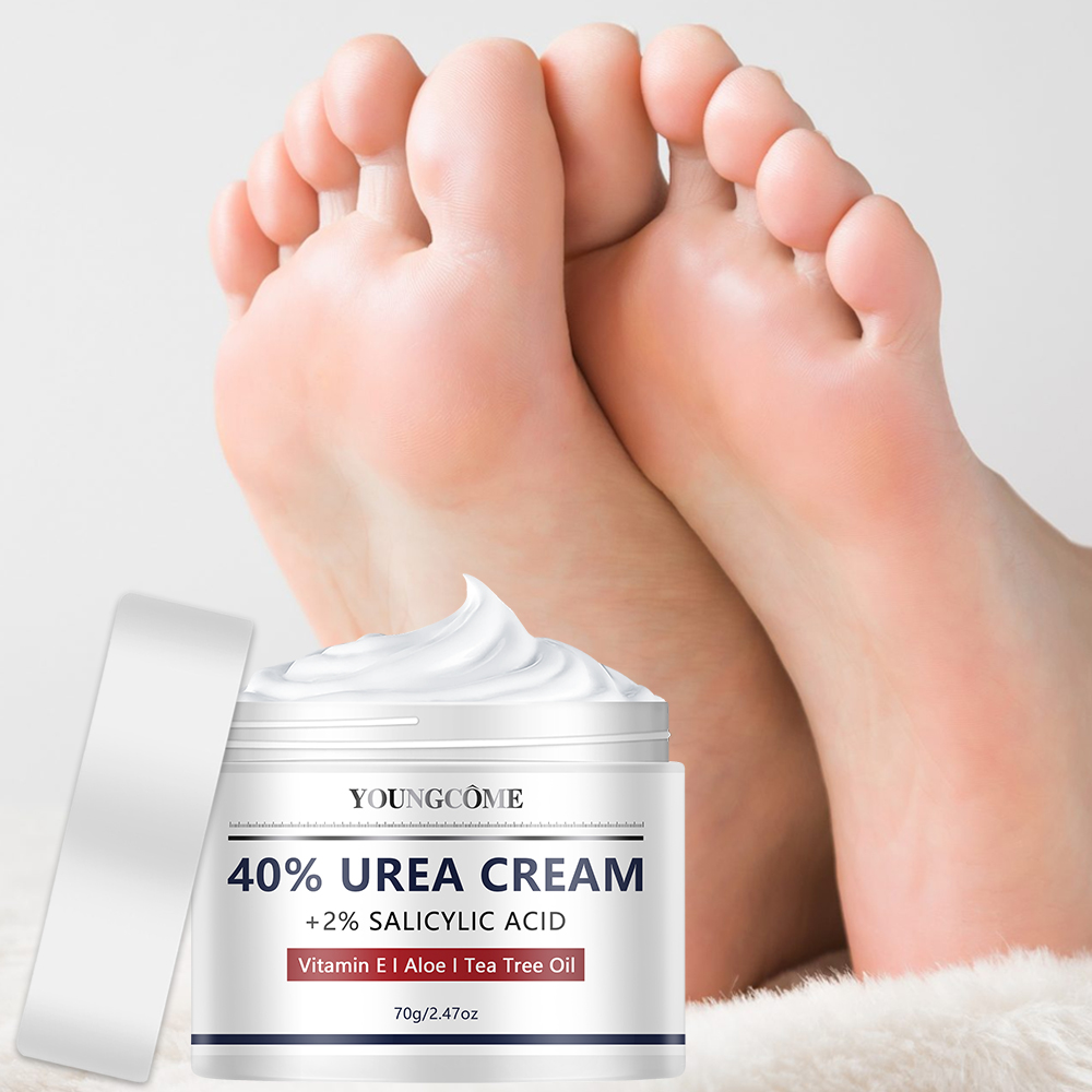 Urea-Creme für Fuß- und Handpf – Azelaic Acid Cream Bewertung und Preis
